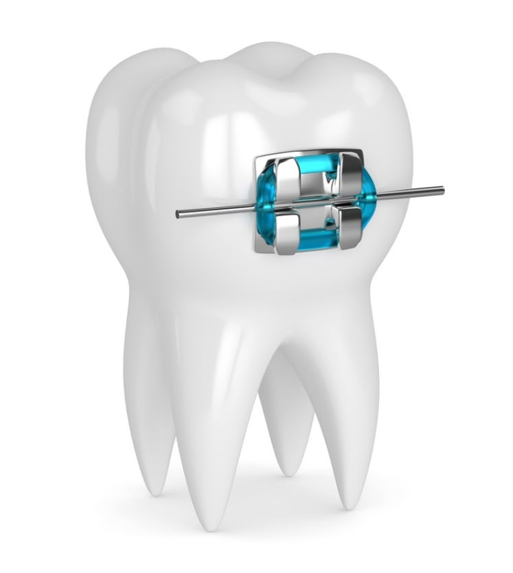 Contraindications Image