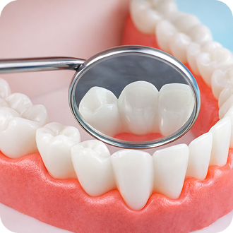 Tooth Decay Treatment
