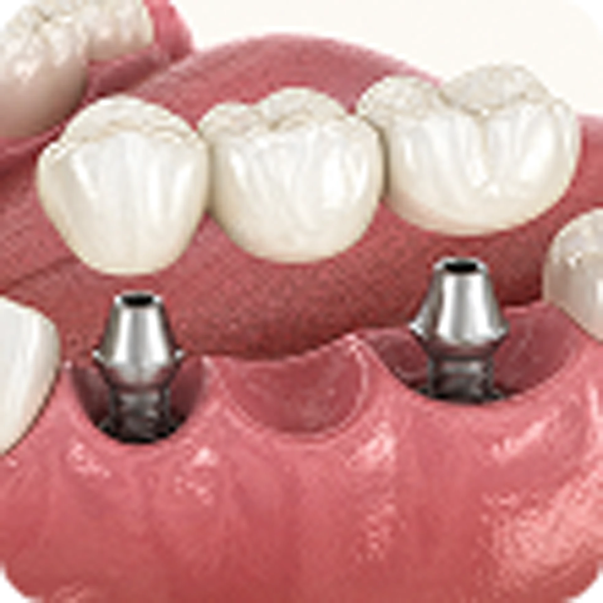 Prosthodontics