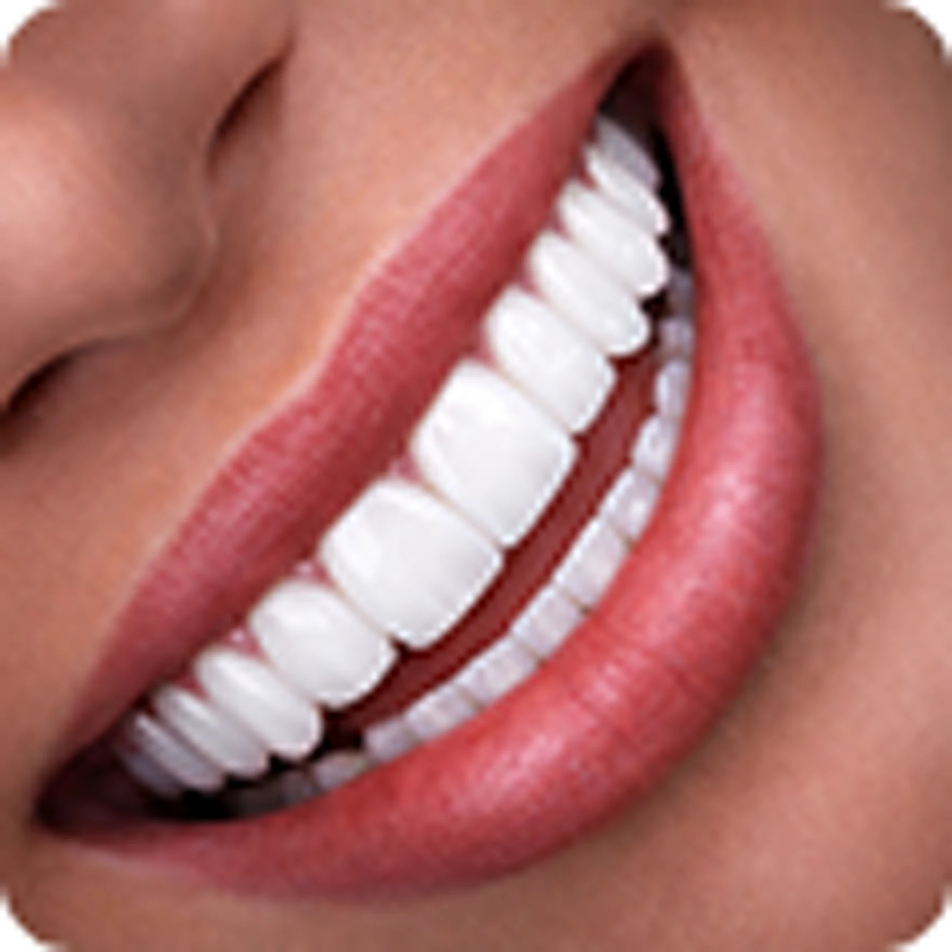 Hollywood Smile