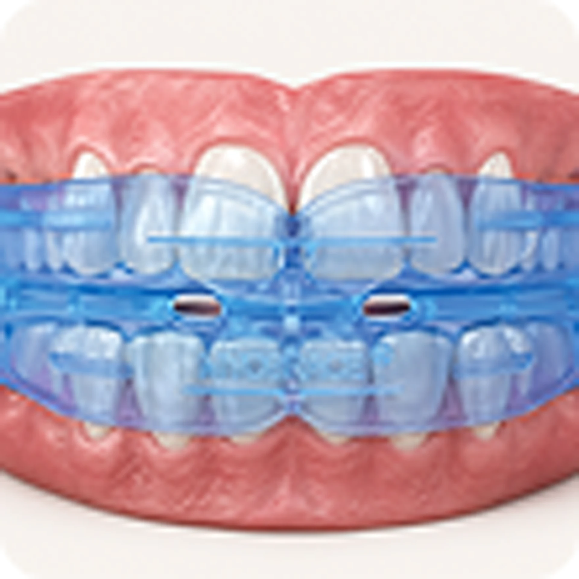 Myobraces