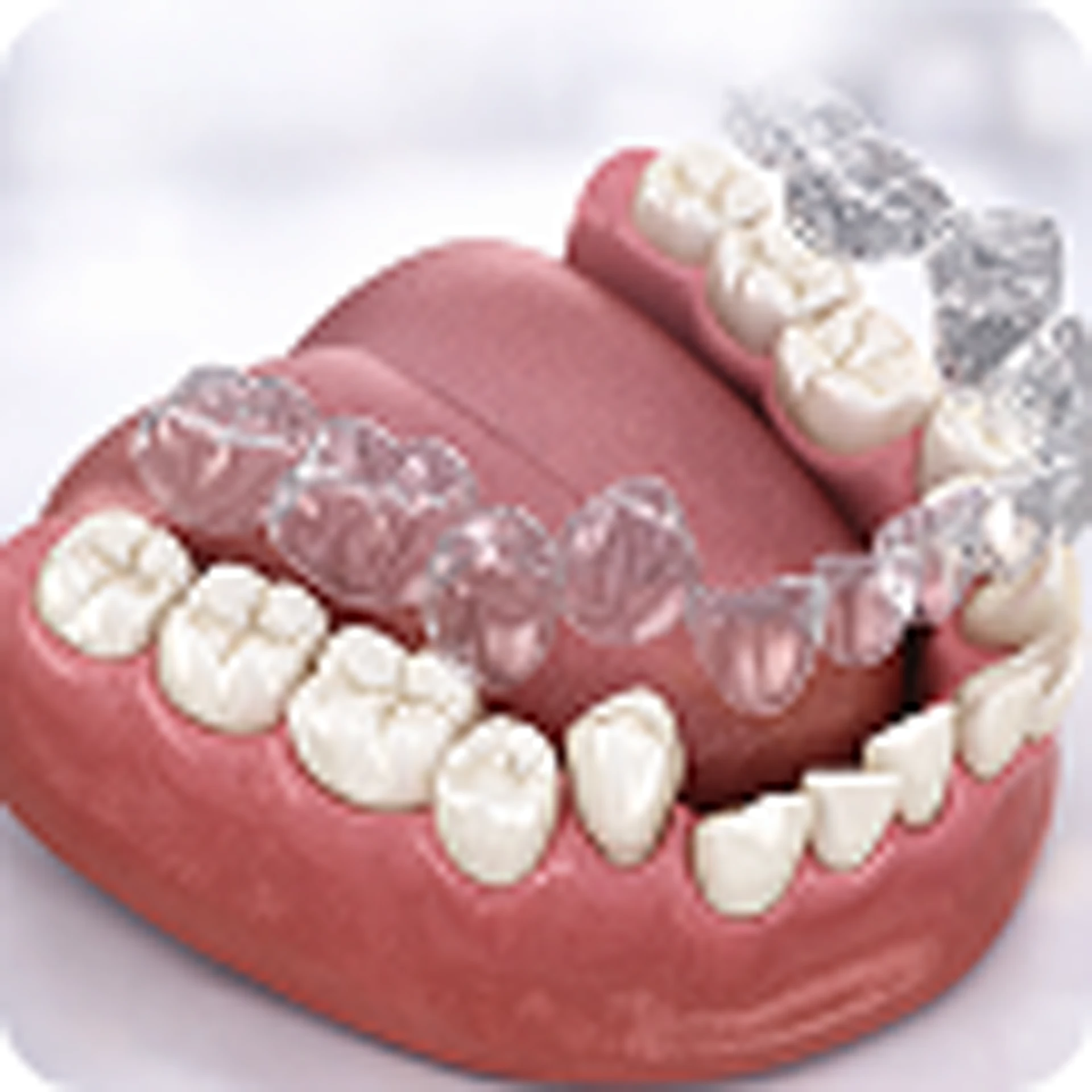 Invisalign