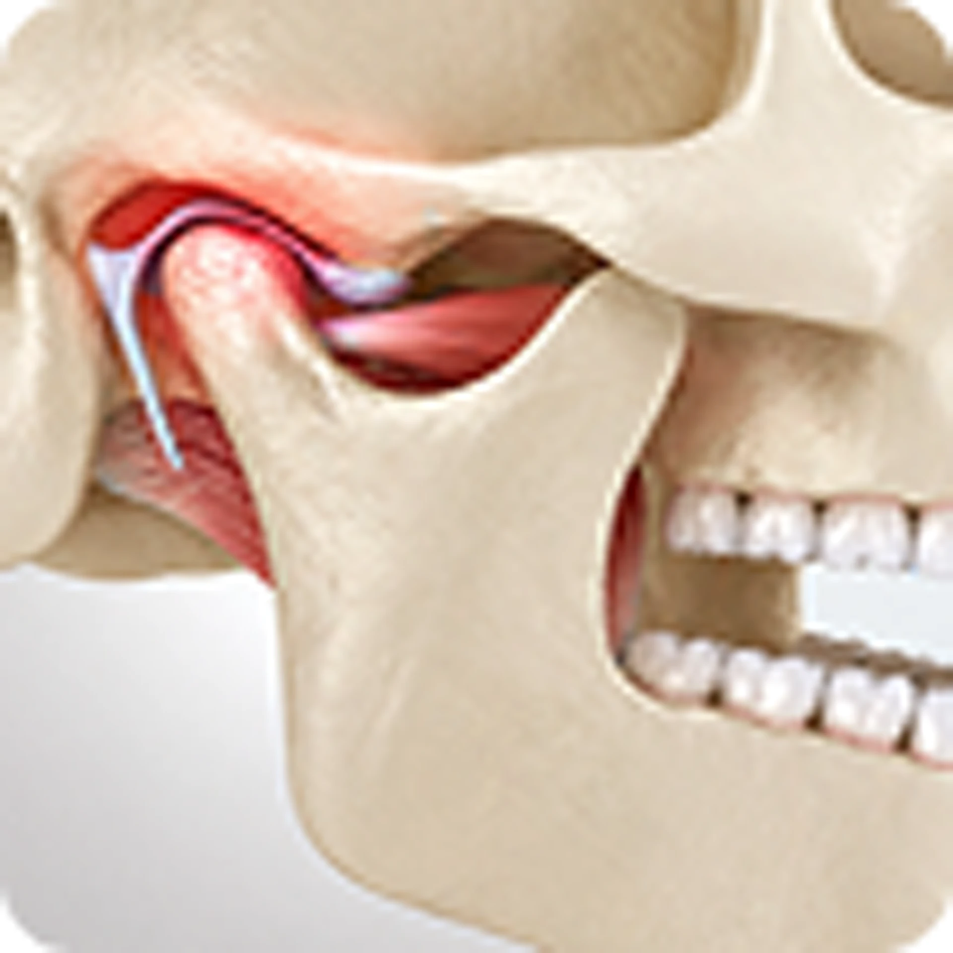 TMJ Treatment