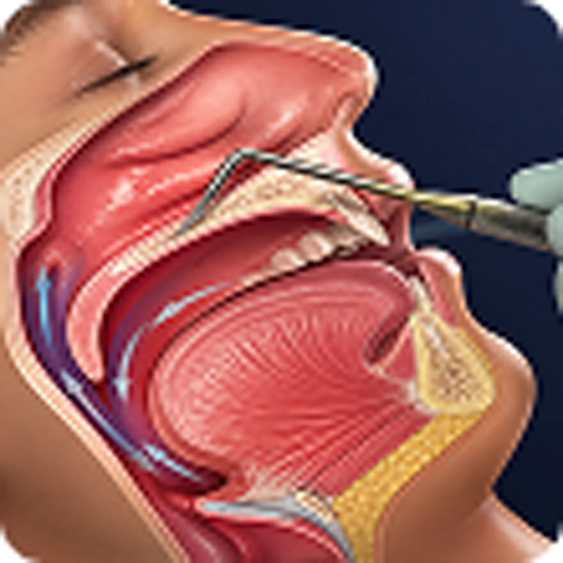 Sleep Apnea & Snoring Treatment