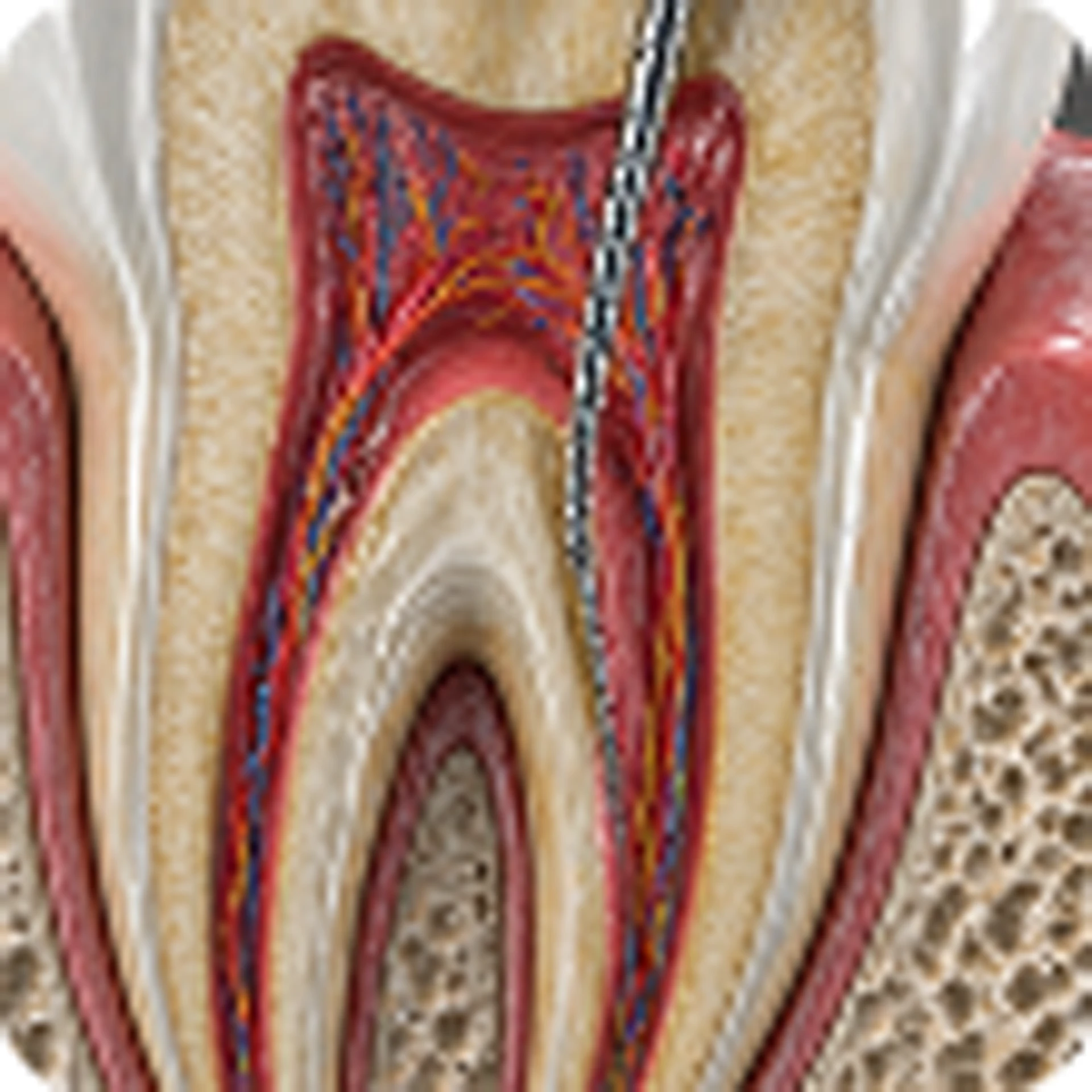 Re-Root Canal Treatment