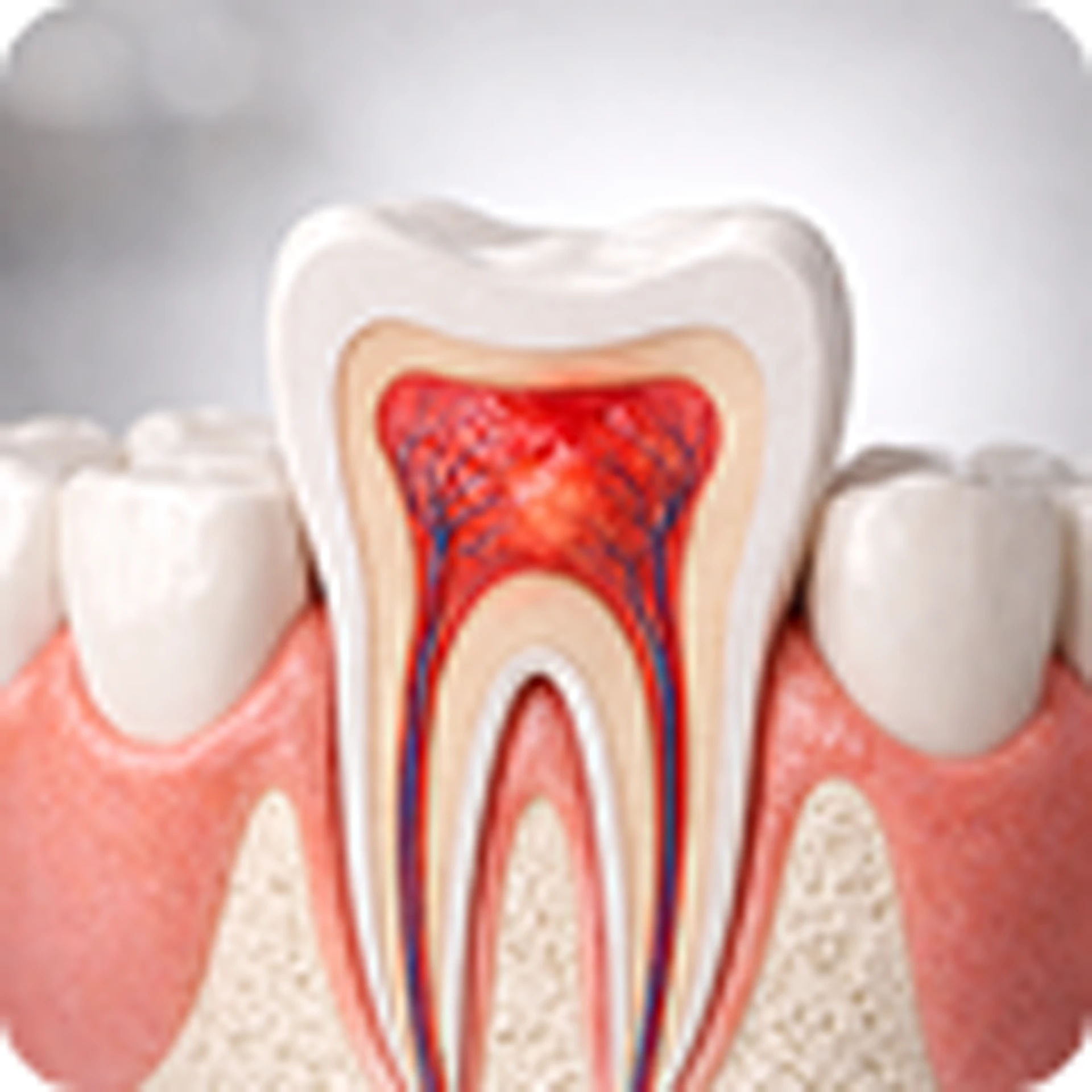 Tooth extraction