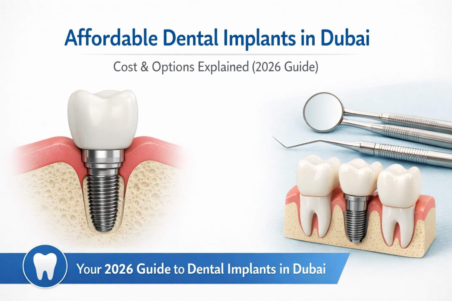 Affordable Dental Implants in Dubai